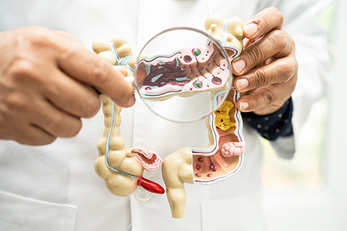 NICE Approves Five AI Tools to Spot Bowel Cancer Earlier - Dr Richard Dune - LearnPac Systems UK - NICE Approves Five AI Tools to Spot Bowel Cancer Earlier - Dr Richard Dune - LearnPac Systems UK -